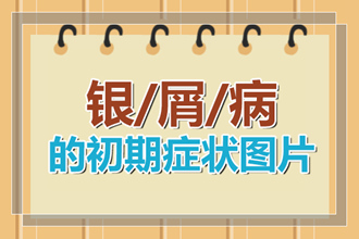 听说使用淡盐水清洗牛皮癣患者患处可以缓解瘙痒真的吗