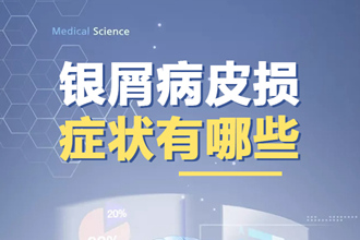 比免疫力更厉害的自控力，能治疗银屑病？这3点治疗方式帮你 