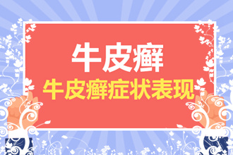 银屑病与润肤剂（图片），润肤剂在银屑病治疗中扮演着怎样的角色？