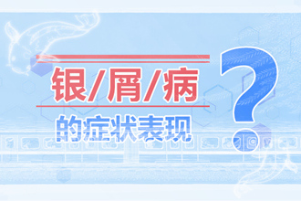药物导致牛皮癣诱发的原因-和激素诱发有什么不同？