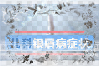 牛皮癣图片患病期间感冒严重吗-【小病 】怎么退烧